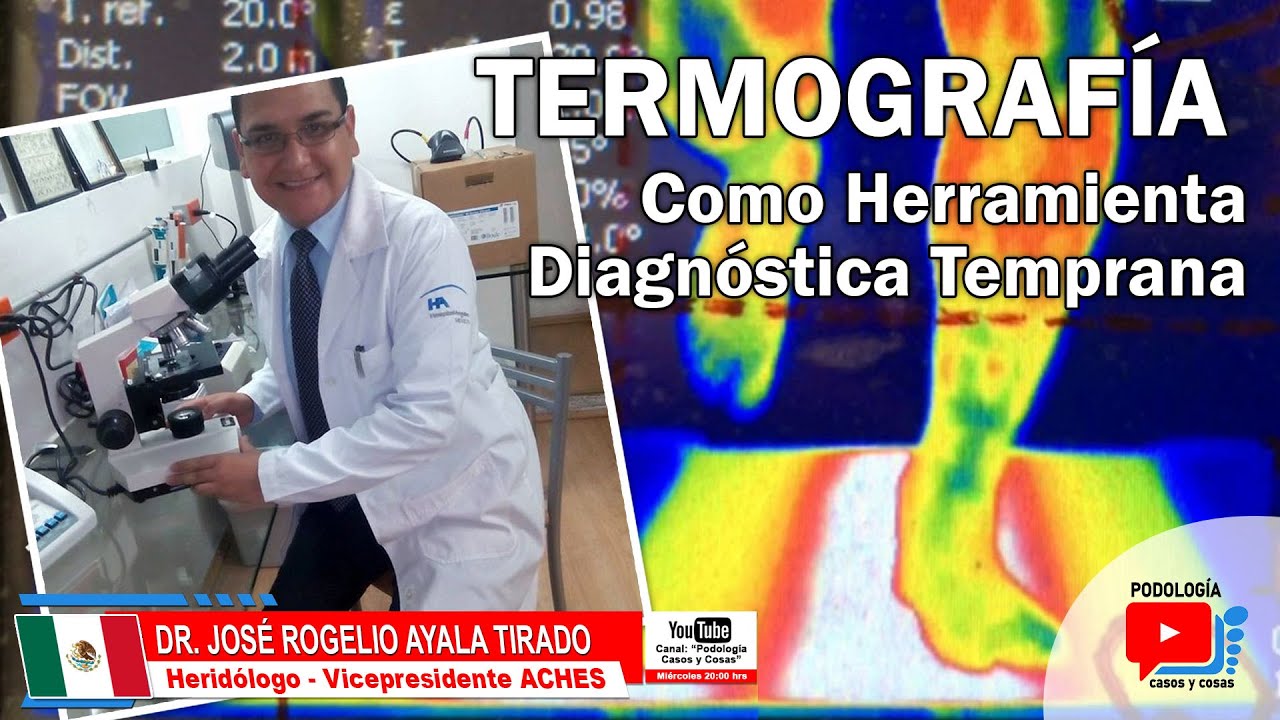 TERMOGRAF&Iacute;A COMO HERRAMIENTA DE DIAGN&Oacute;STICO | Dr. Rogelio Ayala Tirado | Podolog&iacute;a Casos y Cosas