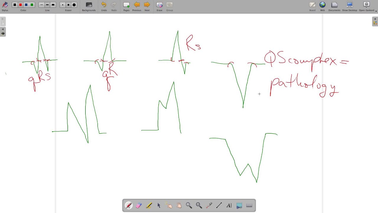 ECG Waves Segments Intervals