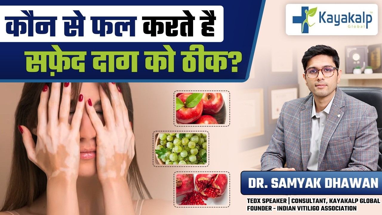 कौन से फल सबसे तेज़ ठीक करते हैं सफ़ेद दाग? | Best Fruits for Vitiligo Recovery | Kayakalp Global