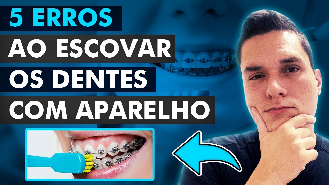 5 ERROS AO ESCOVAR OS DENTES COM APARELHO ORTODÔNTICO!!!