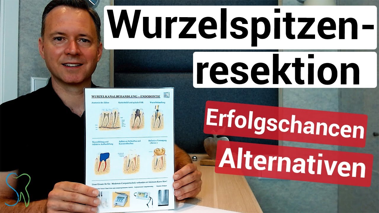 Wurzelspitzenrezektion WSR | Sinnvoll? Letzte Alternative? Risiken und Erfolgsaussichten