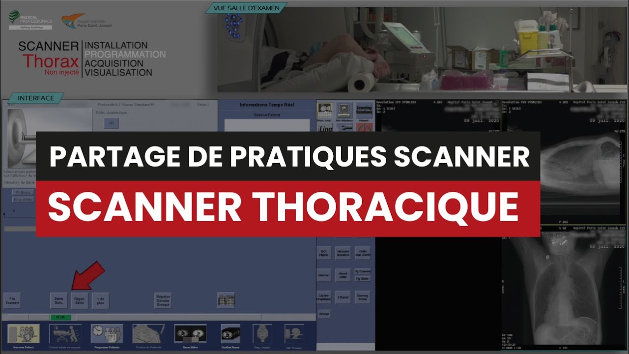CT Scanner THORACIQUE (Sans Injection) - Partage de Pratiques