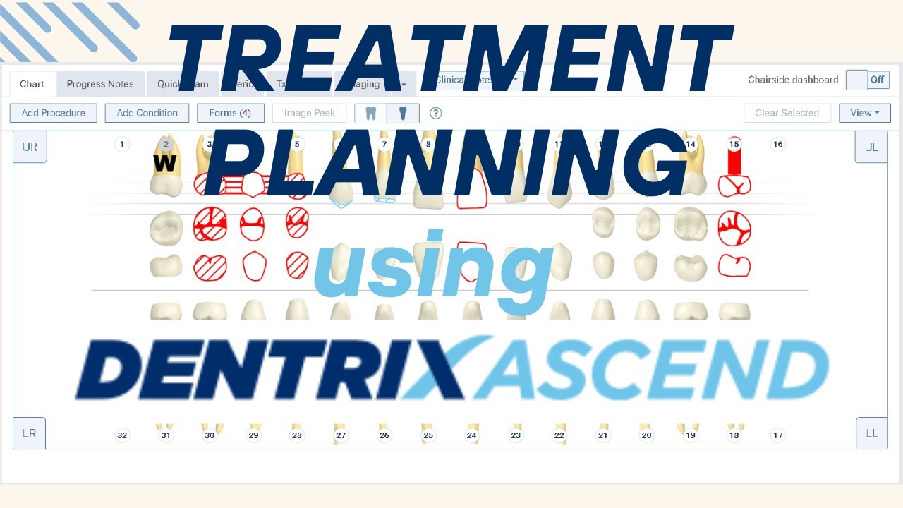 🎥 How to Treatment Plan in Dentrix Ascend | Dental Ops Pro