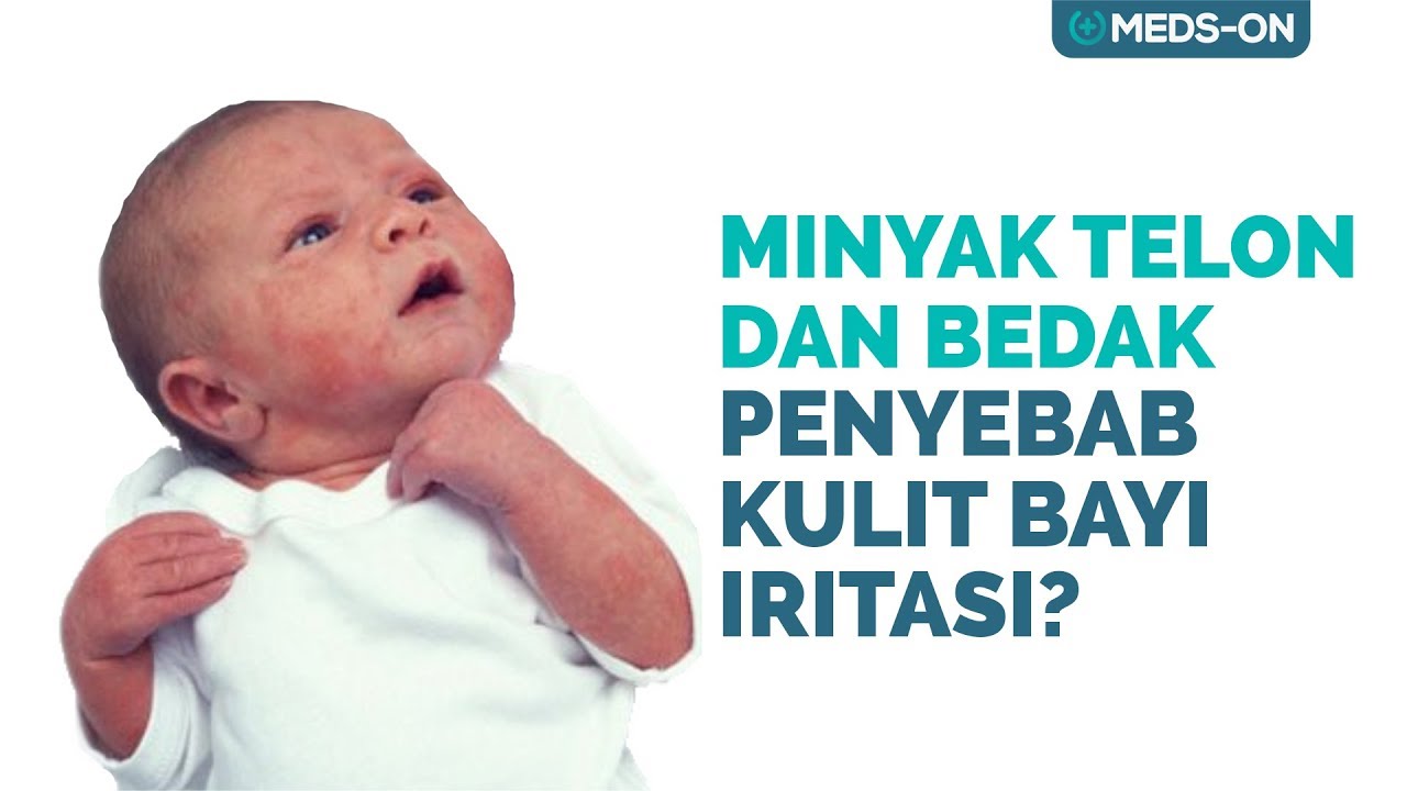 10 Tips Merawat Bayi Baru Lahir [Bagian-2] | Meds-On