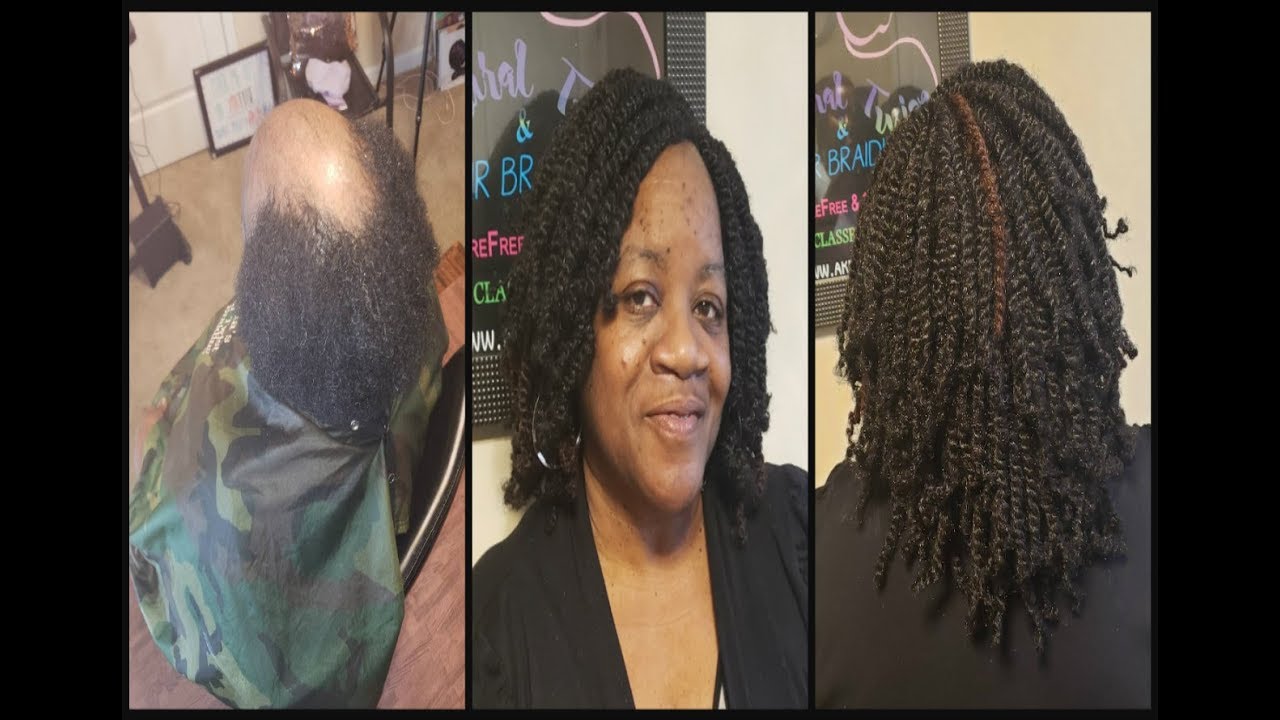Alopecia | AKIYIAKELLY Crochet Weaving Net Twist