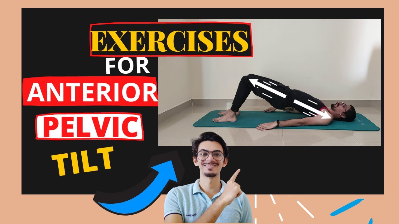 Exercises for Anterior Pelvic Tilt 丨Fix bad Posture 丨Hindi 丨No more Back Pain 丨PhysioSthaan