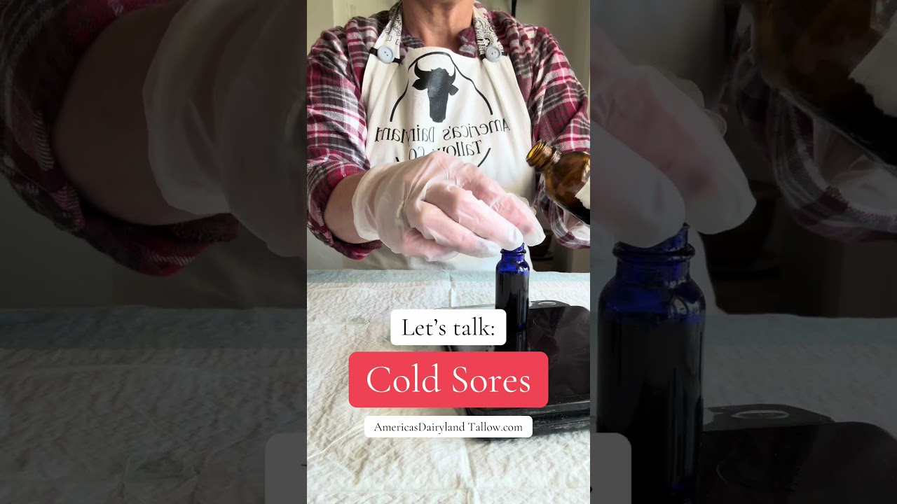 COLD SORES! Let’s get rid of them and get some relief! 