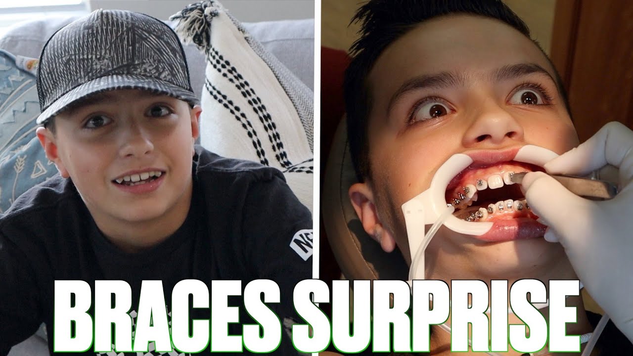 SURPRISING OUR SON WITH BRACES FOR THE FIRST TIME | GETTING BRACES FOR THE FIRST TIME SURPRISE