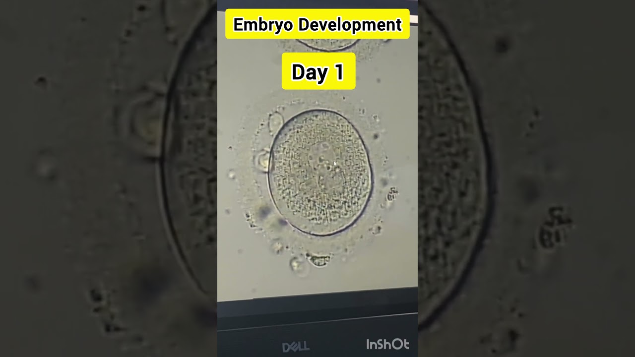 Embryo development process in IVF #embryology #embryodevelopment #embryologist #ivf #ivfprocess