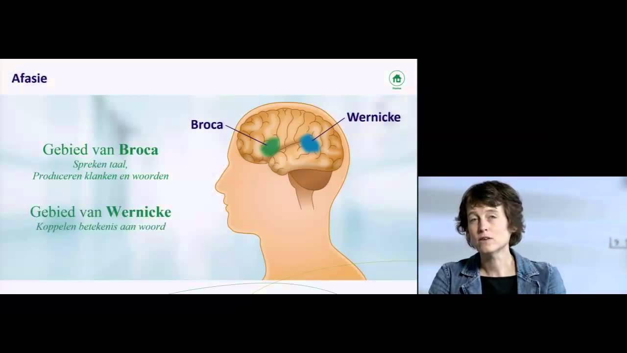 Hoe ontstaat afasie