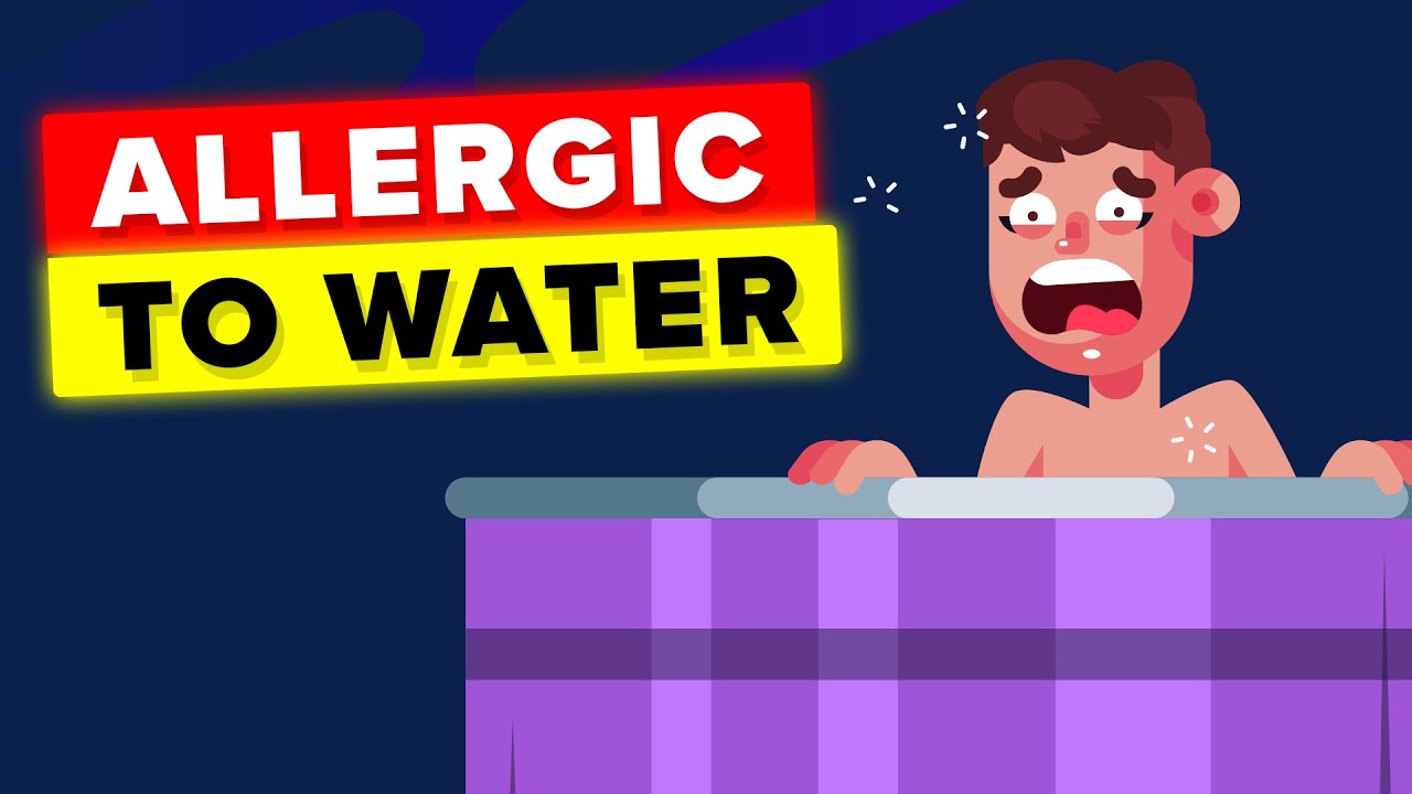 Woman Allergic to Water, This is How She Lives