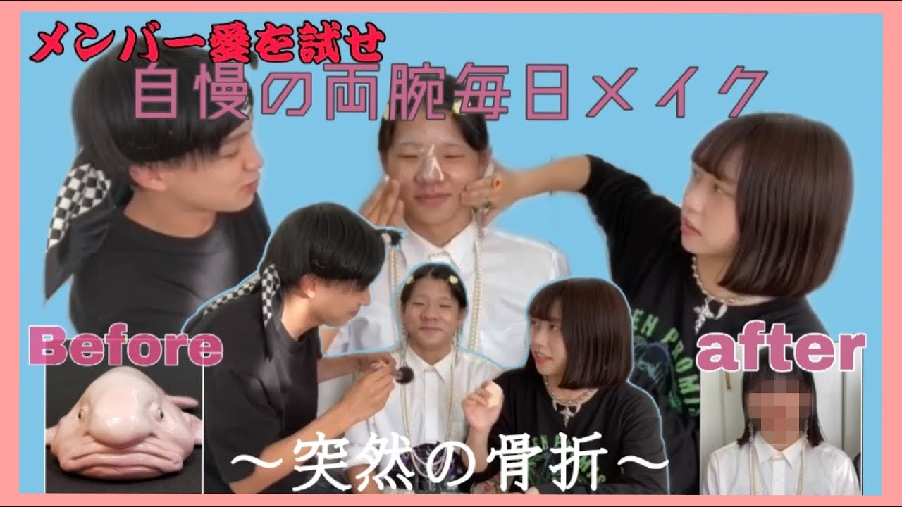 【緊急事態】骨折したから骨折メイクしてね？