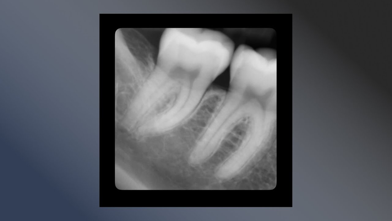 Sorry Mom - Teeth (Official Audio)