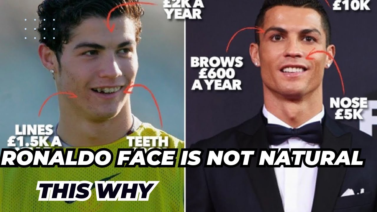 Cristiano Face Is Not Natural: This s Why- A Transformation Journey