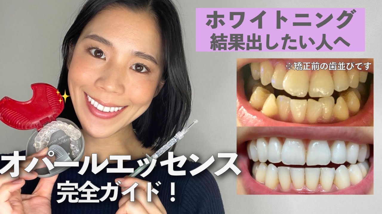 【徹底解説】濃度の説明/体験談/コツ/費用など詳しく解説 〜ホワイトニングするならこれ！