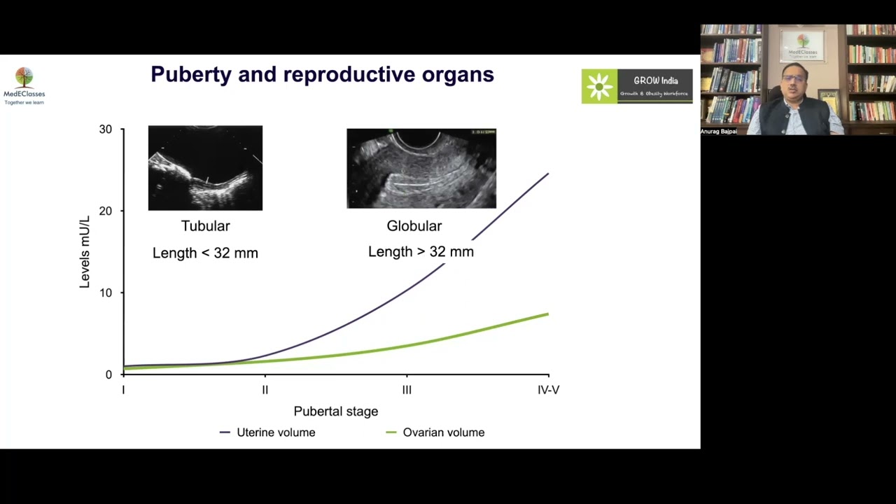 MedEClasses Module Approach to Precocious Puberty in girls