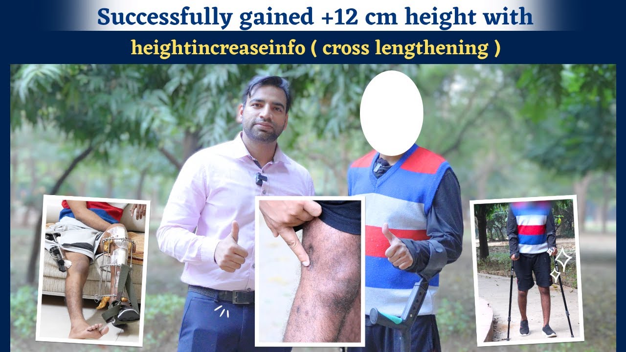 Successfully gained +12 cm height with heightincreaseinfo ( cross lengthening )