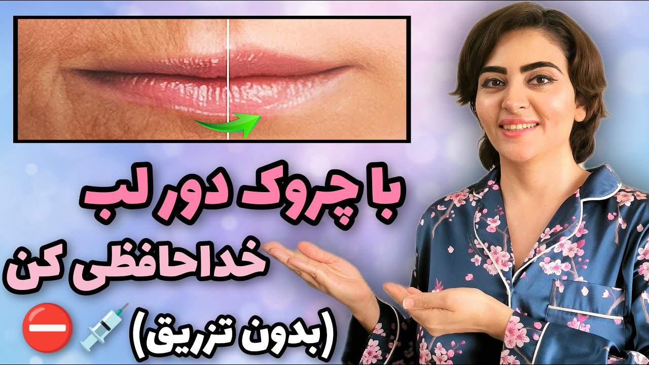 رفع چین و چروک دور لب و دهان بدون تزریق فیلر | درمان افتادگی لب‌ها با یوگای صورت