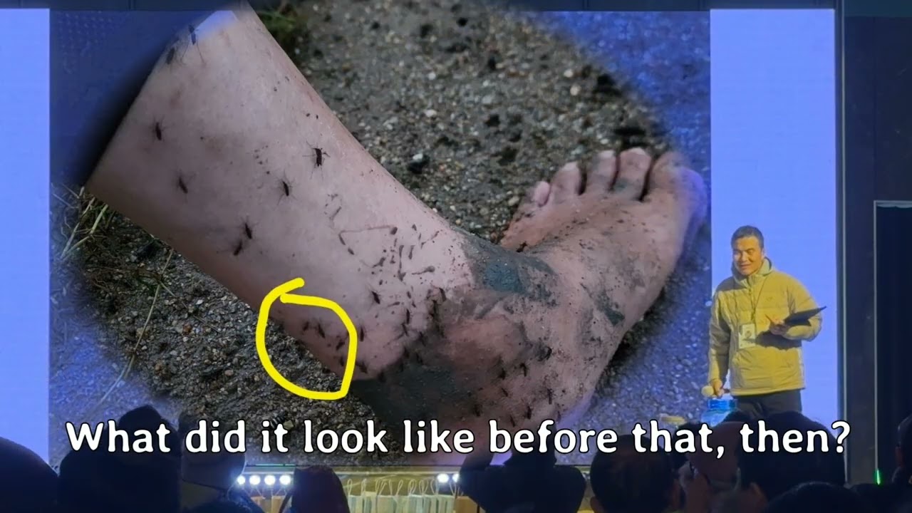 Barefoot Lecture 25: 2weeks barefoot walking awakened numbness of 9 years serious traffic accidents!