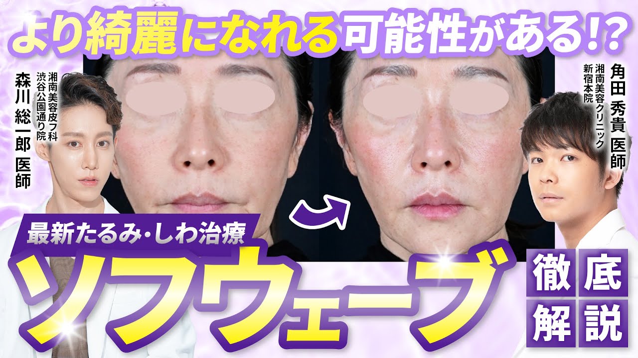 【史上最強】皮膚のたるみを引き締める『ソフウェーブ』徹底解説