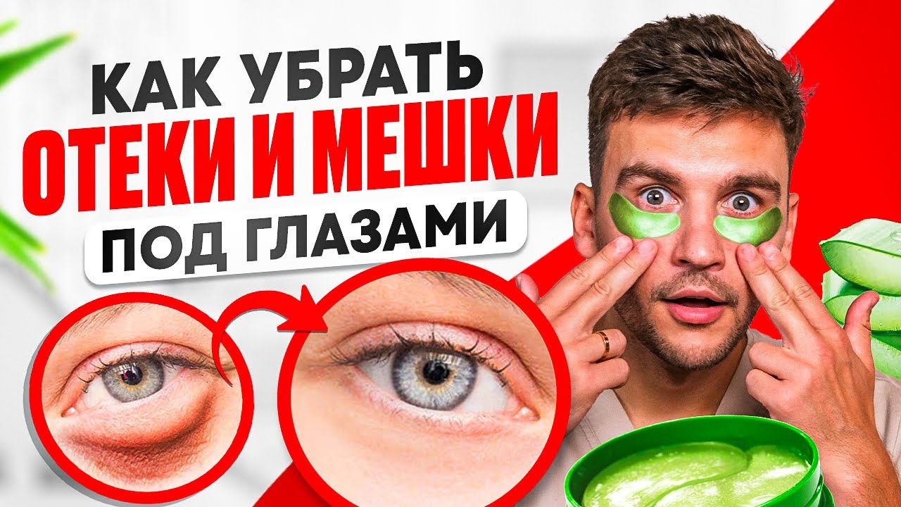 Мешки под глазами УЙДУТ МГНОВЕННО! / Простое упражнение от ОТЁКОВ под ГЛАЗАМИ!