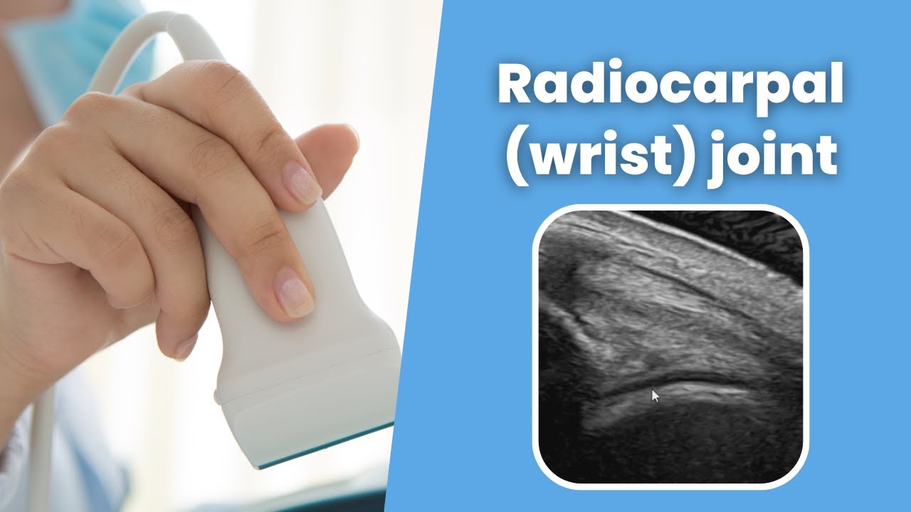 Radiocarpal (wrist) joint - MSKUS - How to scan the Radiocarpal (wrist) joint - 2 minute Tuesday