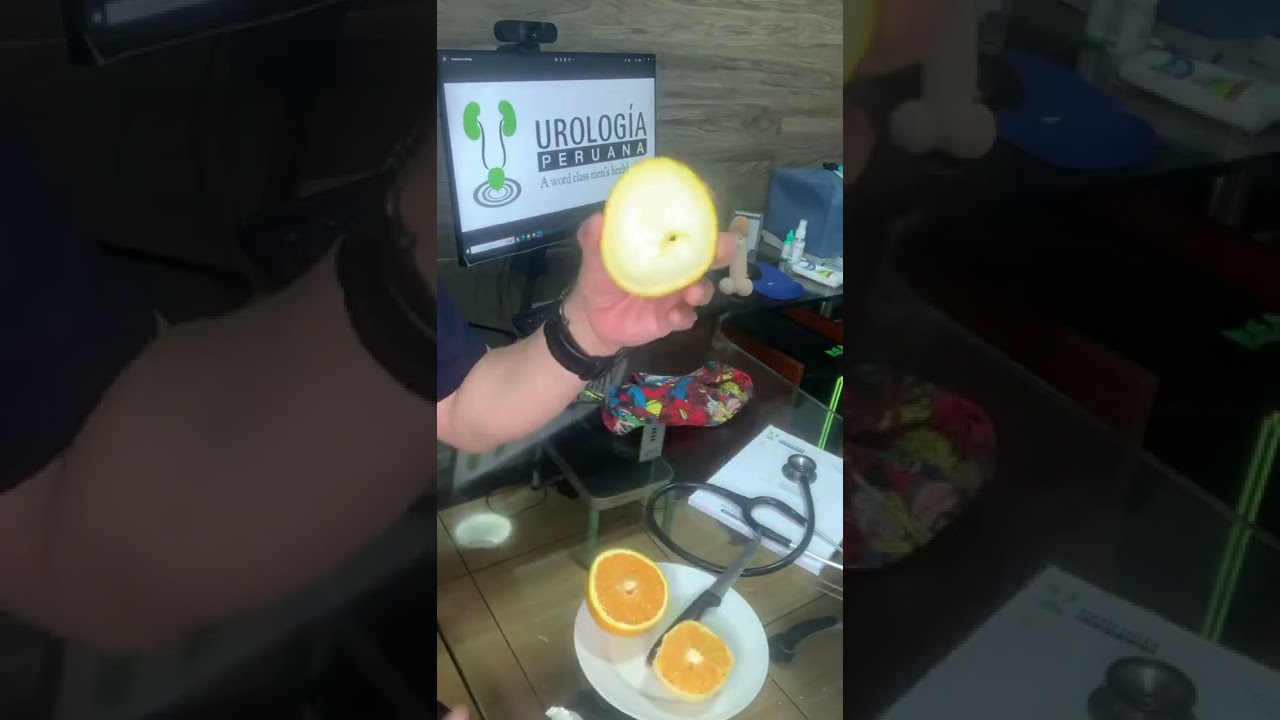 Cómo se opera la próstata mediante cirugía abierta