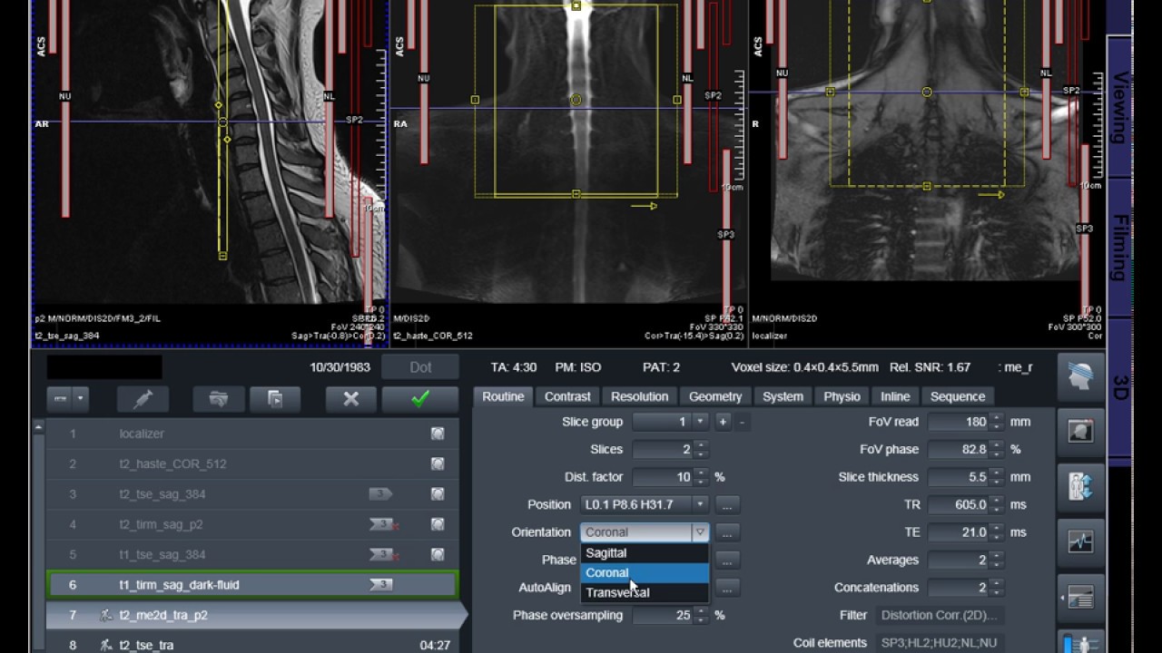 Syngo MRI Protocol cards