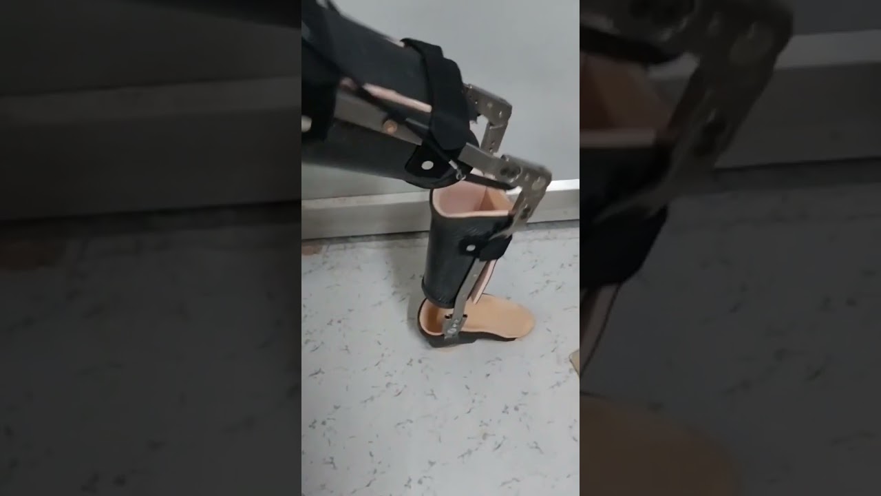 Autolocking Polio leg caliper kafo brace with imported US made components  available @mycaremedical