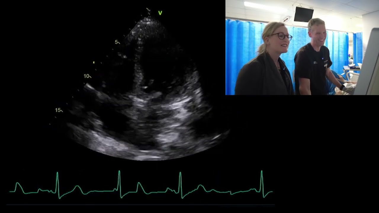 Live case: Fluid assessment with echo in patient with septic shock and severe AS