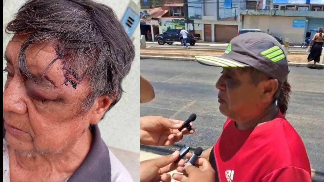 Evalúan medidas de protección para adulto mayor que denunció haber sido agredido por policía