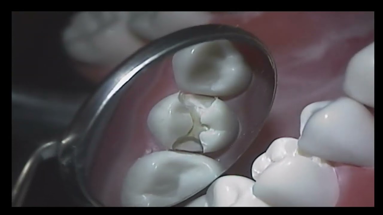 Dentistry Demo - 29 MOD Amal