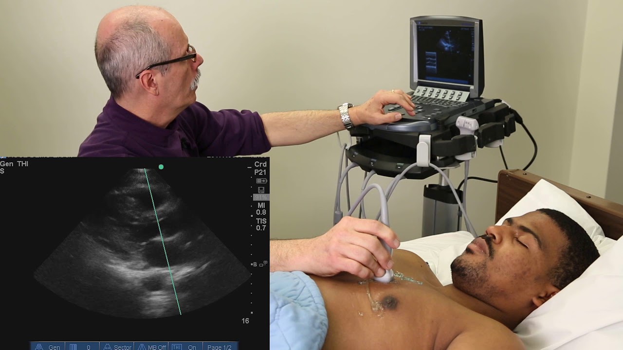 Advanced Critical Care Echocardiography - Complete Exam