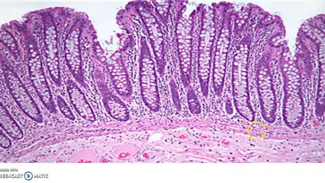 histología del colon