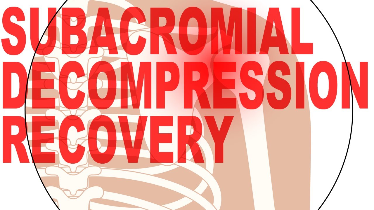 Shoulder Surgery Subacromial Decompression Recovery Protocol