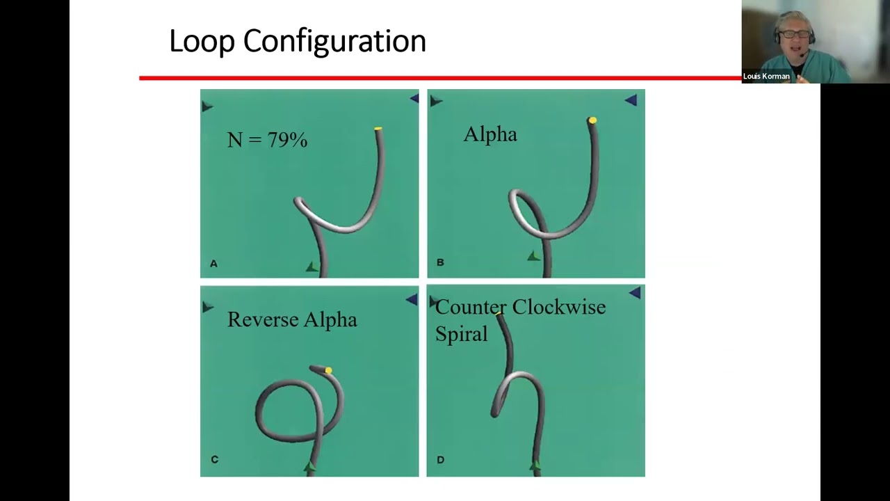 Defining Skill in Endoscopy: Quantifying the Force