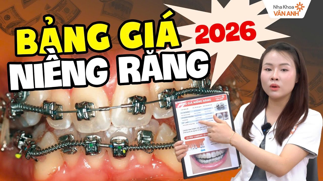 [MỚI NHẤT] Bảng Giá Niềng Răng Nha Khoa Vân Anh 2026
