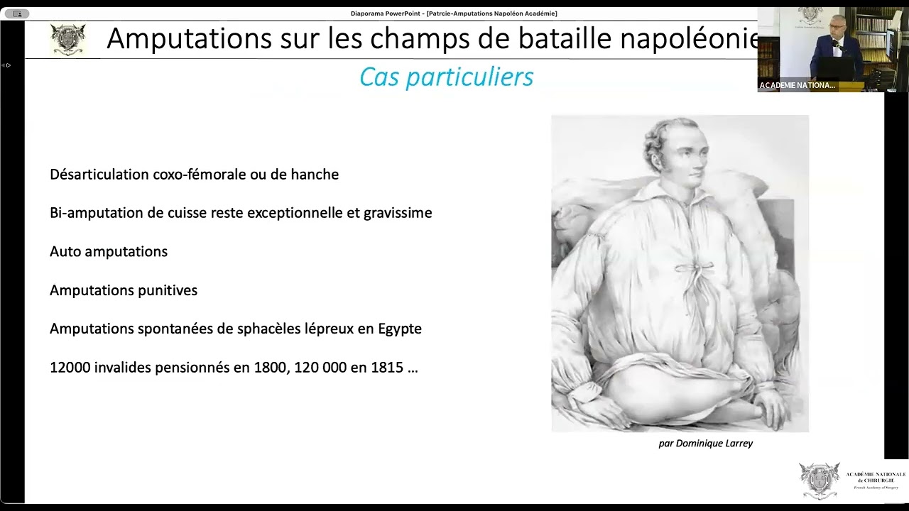 09 Amputation – Indications et techniques sous l’Empire