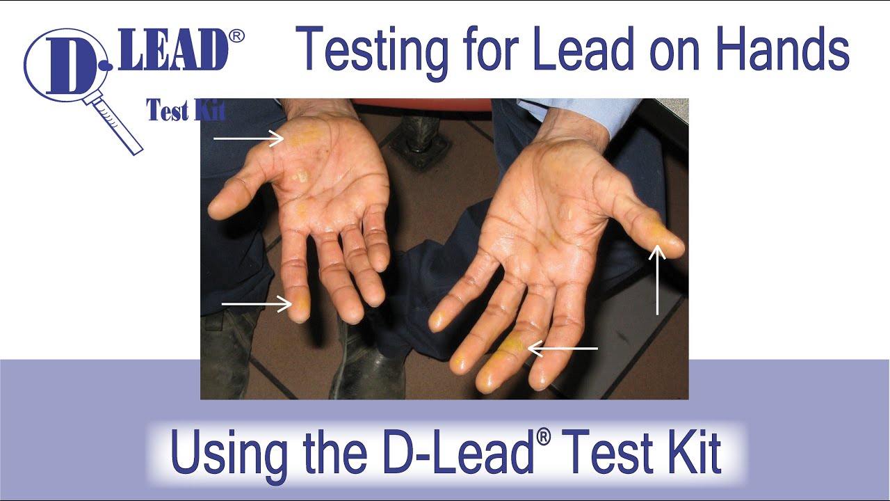 D-Lead Test Kit - A Test for Lead on Hands and Skin