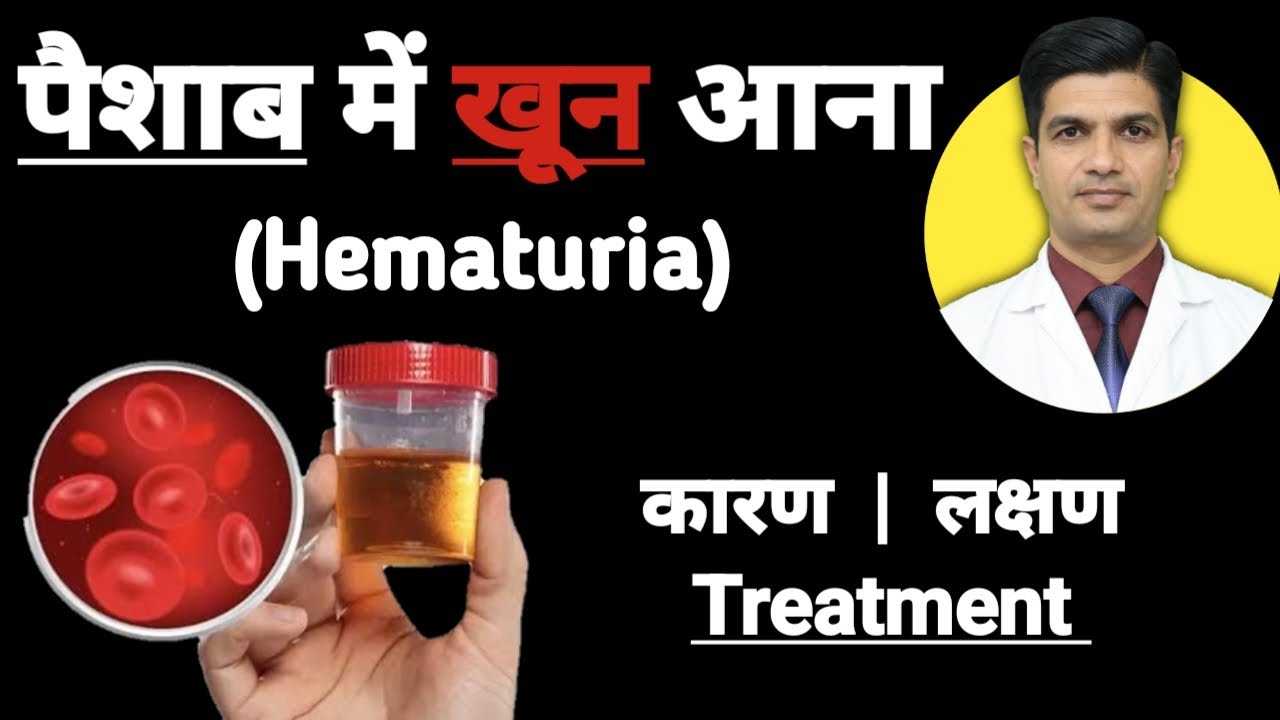 Urine मे ब्लड क्यों आता है इलाज़ | Hematuria in hindi | Hematuria