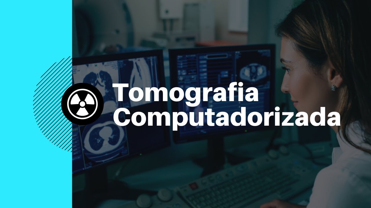 Vídeo Aula 004 - Introdução Tomografia Computadorizada [Radiologia na Palma da Mão]
