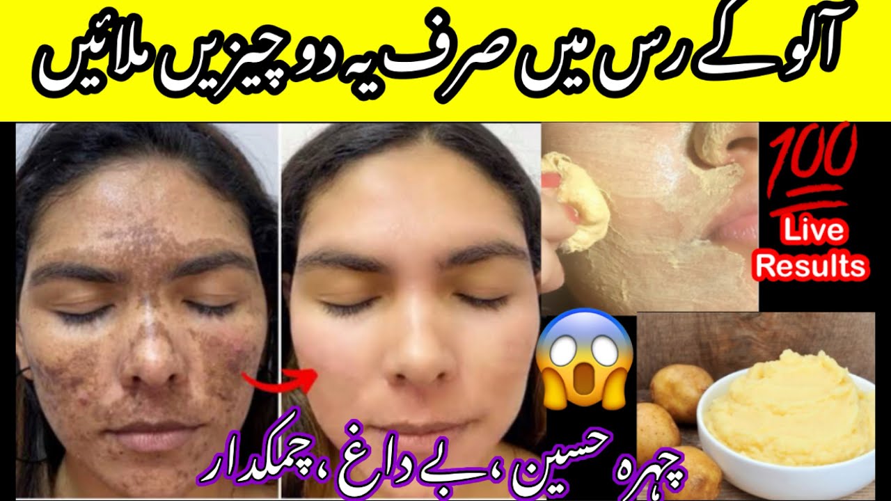 DIY Potato Face Mask for Glowing Skin | Remove Dark Spots & Pigmentation Naturally | Besan Face Mask