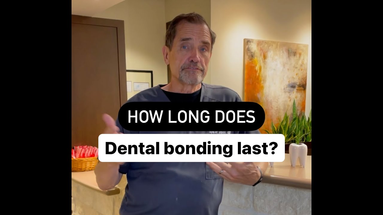 How long does dental bonding last?