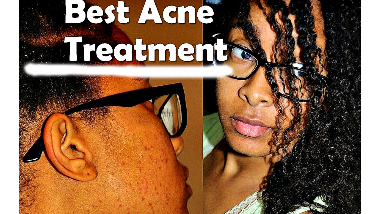 DIY Turmeric Face Mask for Acne Scars with Coconut Milk + Royal Jelly