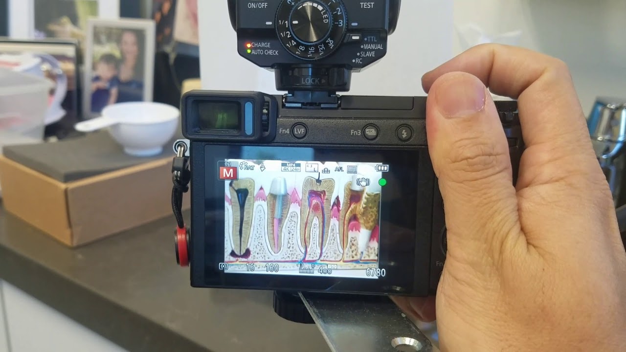 Gx-85: Manual focus and Back Focus