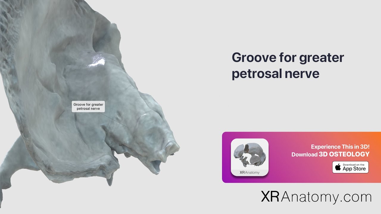 Temporal Bone   Groove for greater petrosal nerve