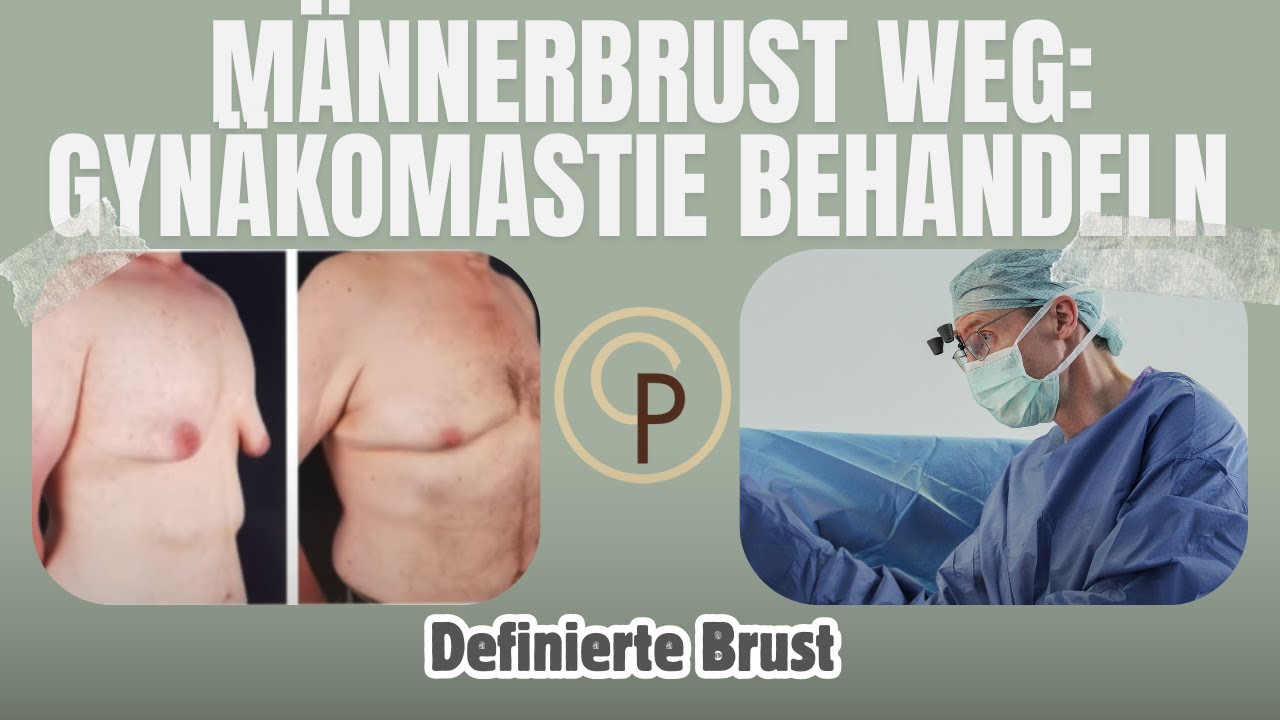 Männerbrust (Gynäkomastie) behandeln: So verschwindet das Fettgewebe!