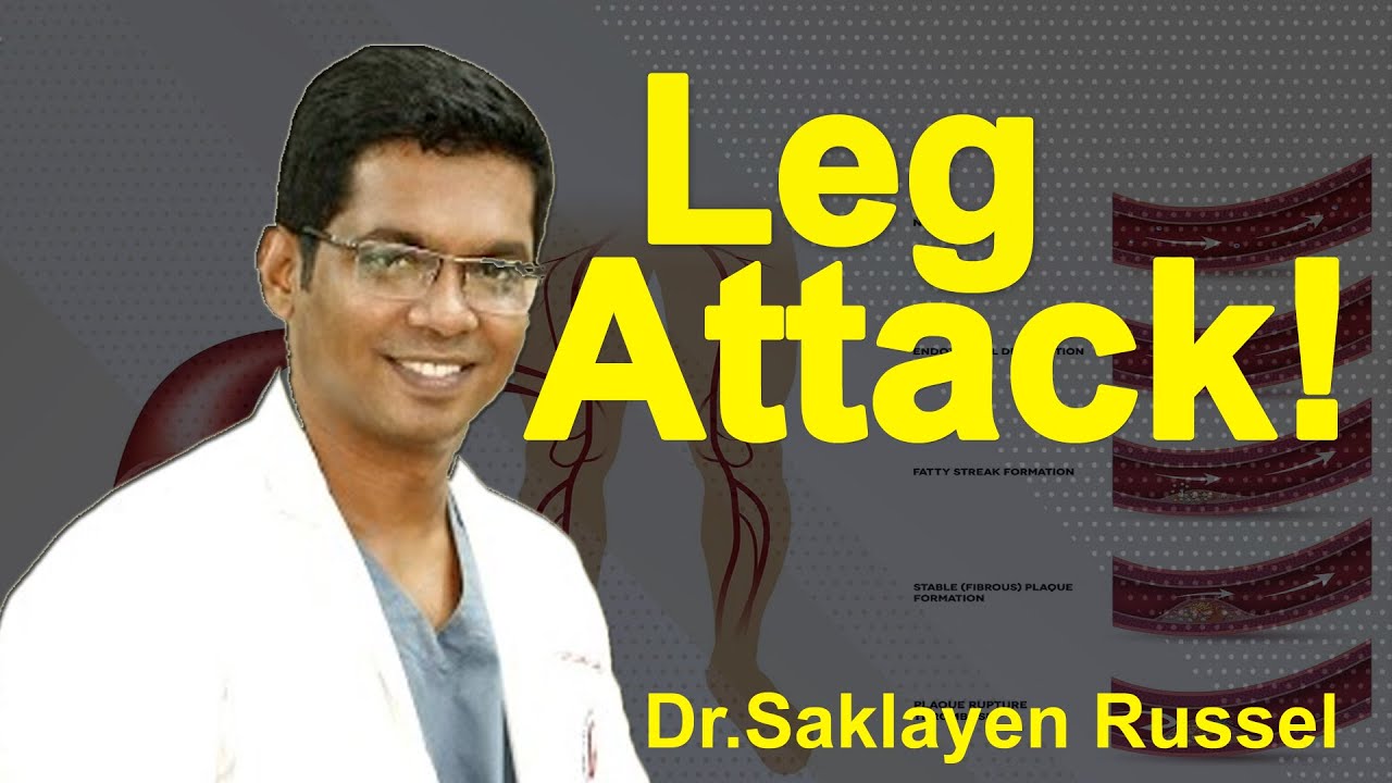 Leg attack। পায়ের রক্তনালীর ব্লক ! Dr. Saklayen Russel। Doctors Tv BD