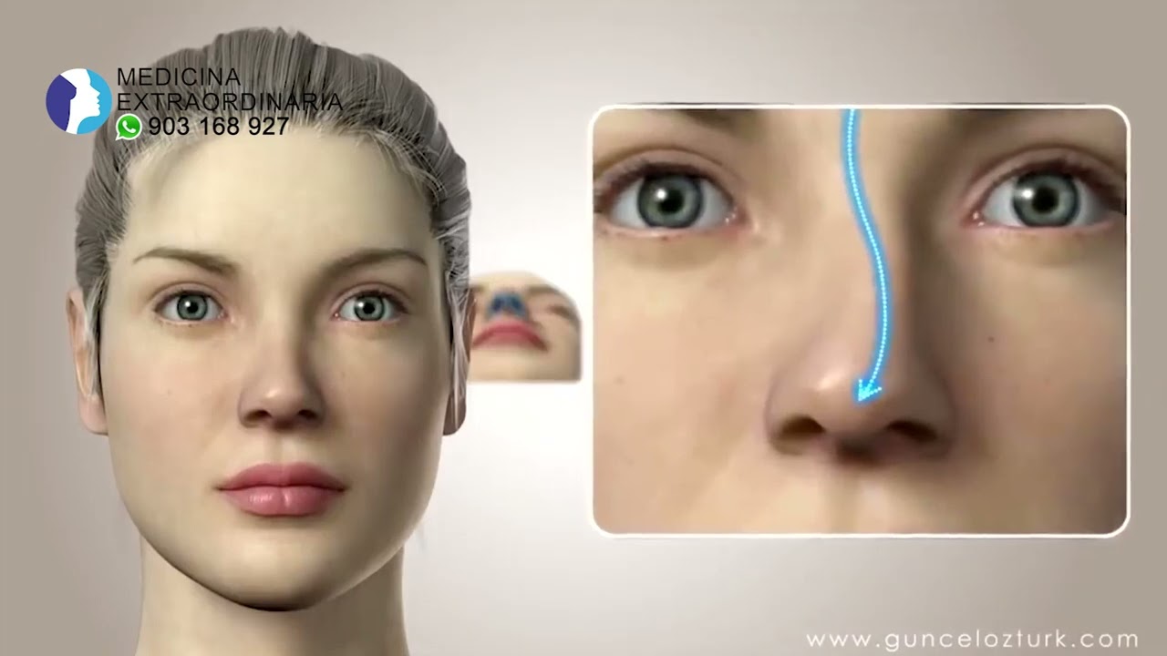 ¿Cuánto CUESTA una CIRUGÍA PLÁSTICA? ¿Por qué se diferencian los PRECIOS? 👸 Dr Percy Nevado
