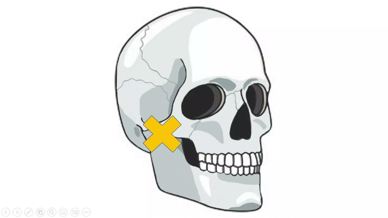 The Physiology of Dental Anesthetics: Trismus